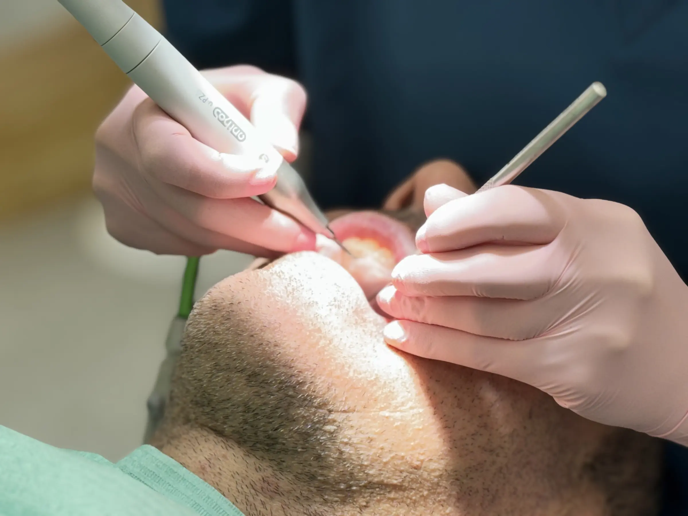 Atención periodontal en Clínica Nós Dental Lugo
